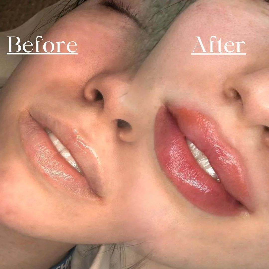 Side-by-side comparison of lips before and after a lip blush treatment.